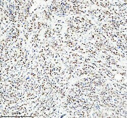 Invitrogen HEF1 Polyclonal Antibody 100 &mu;g | Buy Online | Invitrogen&trade; | Fisher Scientific