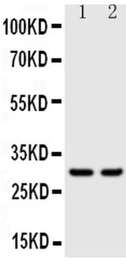 Invitrogen Kallikrein 1 Polyclonal Antibody 100 &mu;g; Unconjugated:Antibodies,