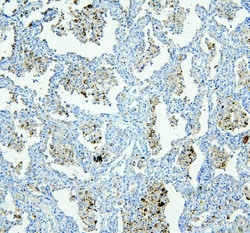 Invitrogen NLRP4G Polyclonal Antibody 100 &mu;g; Unconjugated:Antibodies,