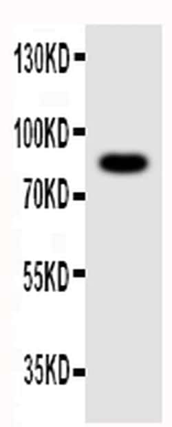 Invitrogen NLRP4G Polyclonal Antibody 100 &mu;g; Unconjugated:Antibodies,