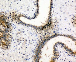 Invitrogen NME1 Polyclonal Antibody 100 &mu;g | Buy Online | Invitrogen&trade; | Fisher Scientific