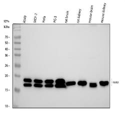 Invitrogen NME1 Polyclonal Antibody 100 &mu;g | Buy Online | Invitrogen&trade; | Fisher Scientific