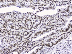 Invitrogen NONO Polyclonal Antibody 100 &mu;g; Unconjugated:Antibodies,