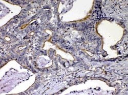 Invitrogen NOV Polyclonal Antibody 100 &mu;g; Unconjugated:Antibodies,