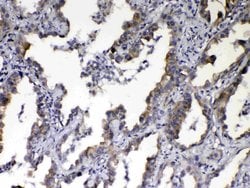 Invitrogen NOV Polyclonal Antibody 100 &mu;g; Unconjugated:Antibodies,