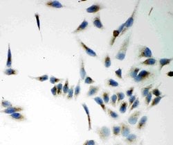 Invitrogen NOX5 Polyclonal Antibody 100 &mu;g; Unconjugated:Antibodies,