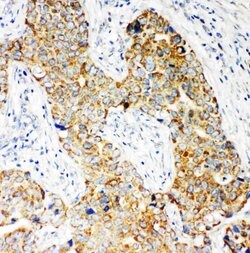 Invitrogen NOX5 Polyclonal Antibody 100 &mu;g; Unconjugated:Antibodies,