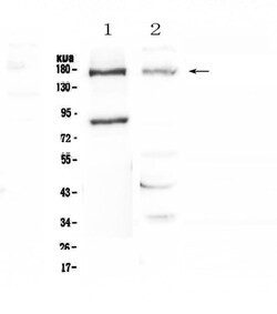 Invitrogen NPC1 Polyclonal Antibody 100 &mu;g | Buy Online | Invitrogen&trade; | Fisher Scientific