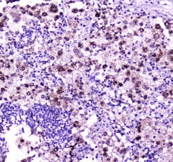 Invitrogen NPC2 Polyclonal Antibody 100 &mu;g; Unconjugated:Antibodies,