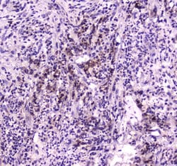 Invitrogen NPC2 Polyclonal Antibody 100 &mu;g; Unconjugated:Antibodies,