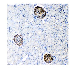 Invitrogen Nephrin Polyclonal Antibody 100 &mu;g; Unconjugated:Antibodies,