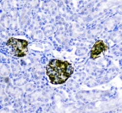 Invitrogen Nephrin Polyclonal Antibody 100 &mu;g; Unconjugated:Antibodies,