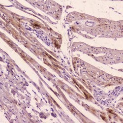 Invitrogen ANP Polyclonal Antibody 100 &mu;g; Unconjugated:Antibodies,