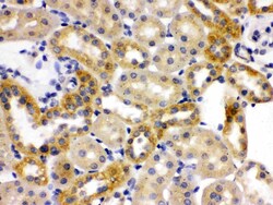 Invitrogen OPA1 Polyclonal Antibody 100 &mu;g; Unconjugated:Antibodies,