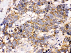 Invitrogen OPA1 Polyclonal Antibody 100 &mu;g; Unconjugated:Antibodies,