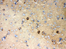 Invitrogen P2X5 Polyclonal Antibody 100 &mu;g; Unconjugated:Antibodies,