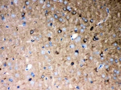 Invitrogen P2X5 Polyclonal Antibody 100 &mu;g; Unconjugated:Antibodies,