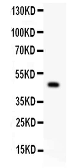 Invitrogen P2X5 Polyclonal Antibody 100 &mu;g; Unconjugated:Antibodies,