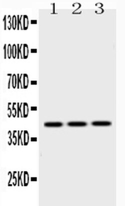 Invitrogen EBP1 Polyclonal Antibody 100 &mu;g | Buy Online | Invitrogen&trade; | Fisher Scientific