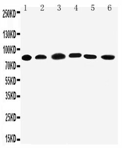 Invitrogen PC1/3 Polyclonal Antibody 100 &mu;g; Unconjugated:Antibodies,