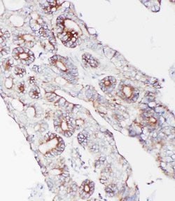 Invitrogen PCSK9 Polyclonal Antibody 100 &mu;g; Unconjugated:Antibodies,