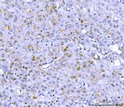 Invitrogen PCSK9 Polyclonal Antibody 100 &mu;g; Unconjugated:Antibodies,