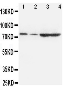 Invitrogen PCSK9 Polyclonal Antibody 100 &mu;g; Unconjugated:Antibodies,