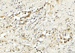 Invitrogen PDCD4 Polyclonal Antibody 100 &mu;g | Buy Online | Invitrogen&trade; | Fisher Scientific
