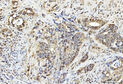 Invitrogen PDCD4 Polyclonal Antibody 100 &mu;g | Buy Online | Invitrogen&trade; | Fisher Scientific
