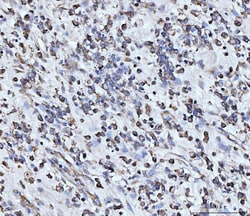 Invitrogen PDCD4 Polyclonal Antibody 100 &mu;g | Buy Online | Invitrogen&trade; | Fisher Scientific