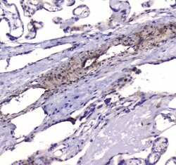 Invitrogen PDE4D Polyclonal Antibody 100 &mu;g; Unconjugated:Antibodies,