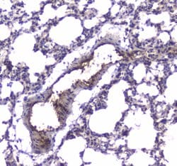 Invitrogen PDE4D Polyclonal Antibody 100 &mu;g; Unconjugated:Antibodies,