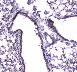 Invitrogen PDE4D Polyclonal Antibody 100 &mu;g; Unconjugated:Antibodies,