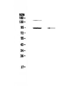 Invitrogen PDE4D Polyclonal Antibody 100 &mu;g; Unconjugated:Antibodies,