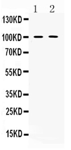 Invitrogen PDE5 Polyclonal Antibody 100 &mu;g | Buy Online | Invitrogen&trade; | Fisher Scientific