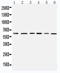 Invitrogen PDK1 Polyclonal Antibody 100 &mu;g; Unconjugated:Antibodies,