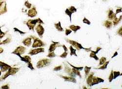Invitrogen PDK2 Polyclonal Antibody 100 &mu;g; Unconjugated:Antibodies,