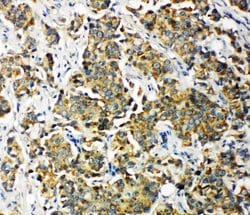 Invitrogen PDK2 Polyclonal Antibody 100 &mu;g; Unconjugated:Antibodies,