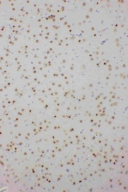 Invitrogen PDK2 Polyclonal Antibody 100 &mu;g; Unconjugated:Antibodies,