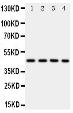 Invitrogen PDK2 Polyclonal Antibody 100 &mu;g; Unconjugated:Antibodies,
