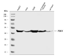 Invitrogen PDK4 Polyclonal Antibody 100 &mu;g | Buy Online | Invitrogen&trade; | Fisher Scientific