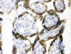Invitrogen PDPK1 Polyclonal Antibody 100 &mu;g; Unconjugated:Antibodies,