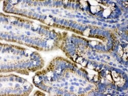 Invitrogen PDPK1 Polyclonal Antibody 100 &mu;g; Unconjugated:Antibodies,