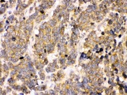 Invitrogen PDPK1 Polyclonal Antibody 100 &mu;g; Unconjugated:Antibodies,