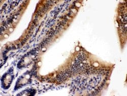Invitrogen PDPK1 Polyclonal Antibody 100 &mu;g; Unconjugated:Antibodies,
