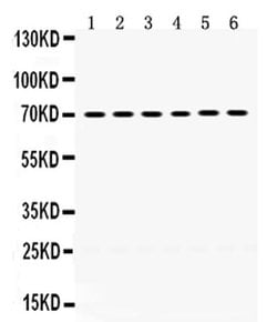 Invitrogen PDPK1 Polyclonal Antibody 100 &mu;g; Unconjugated:Antibodies,