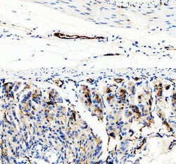 Invitrogen CD31 (PECAM-1) Polyclonal Antibody 100 &mu;g | Buy Online | Invitrogen&trade; | Fisher Scientific