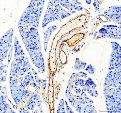 Invitrogen CD31 (PECAM-1) Polyclonal Antibody 100 &mu;g | Buy Online | Invitrogen&trade; | Fisher Scientific