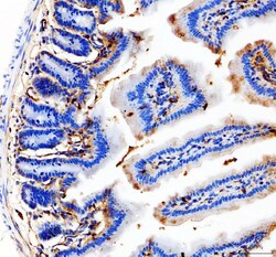 Invitrogen CD31 (PECAM-1) Polyclonal Antibody 100 &mu;g | Buy Online | Invitrogen&trade; | Fisher Scientific