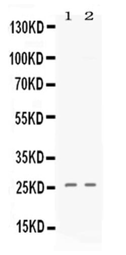 Invitrogen PF4 Polyclonal Antibody 100 &mu;g; Unconjugated:Antibodies,
